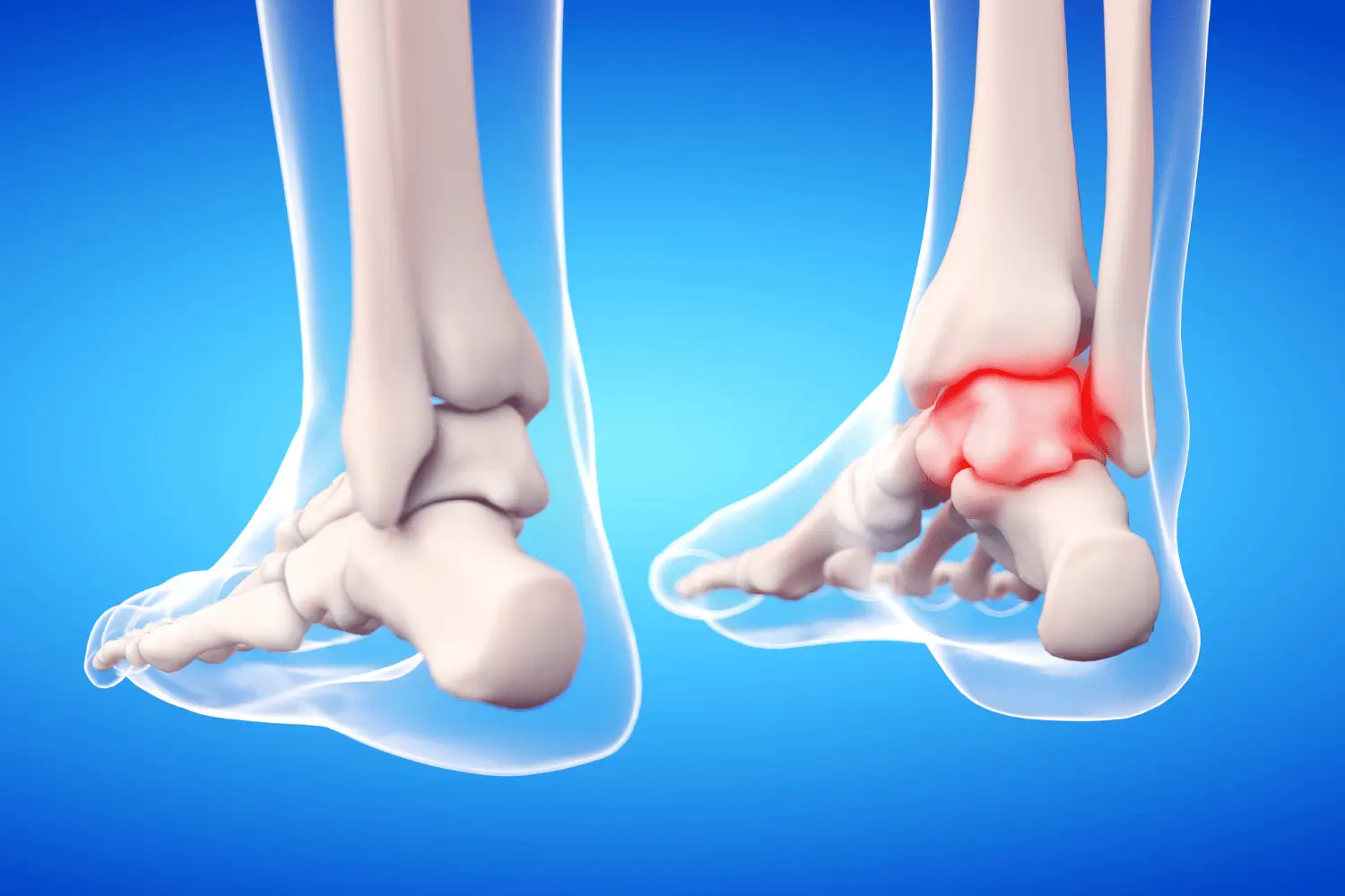 Advanced Treatment for Ankle Problems and Pain Relief