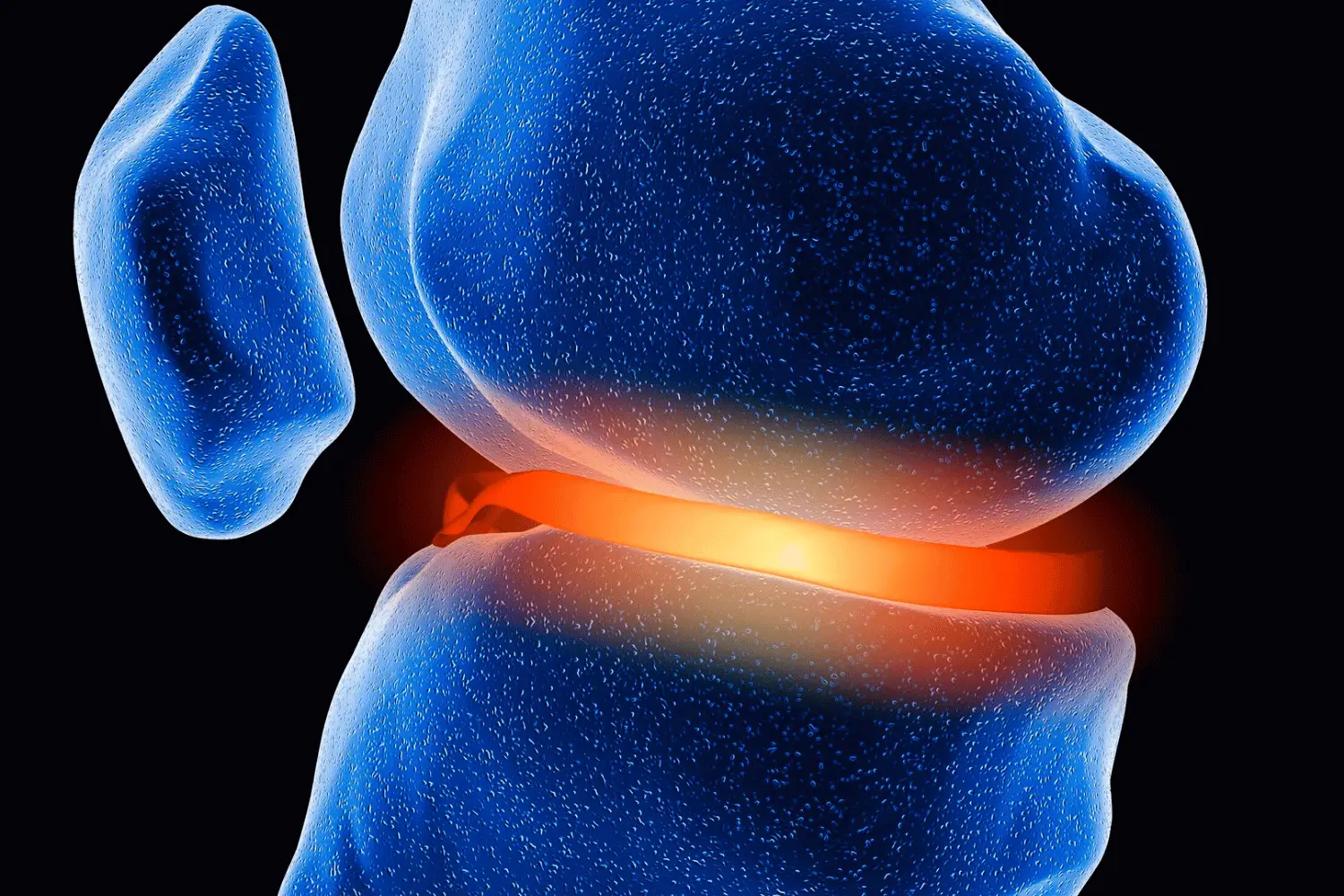 Knee Replacement Surgery in Coimbatore – Advanced Joint Care