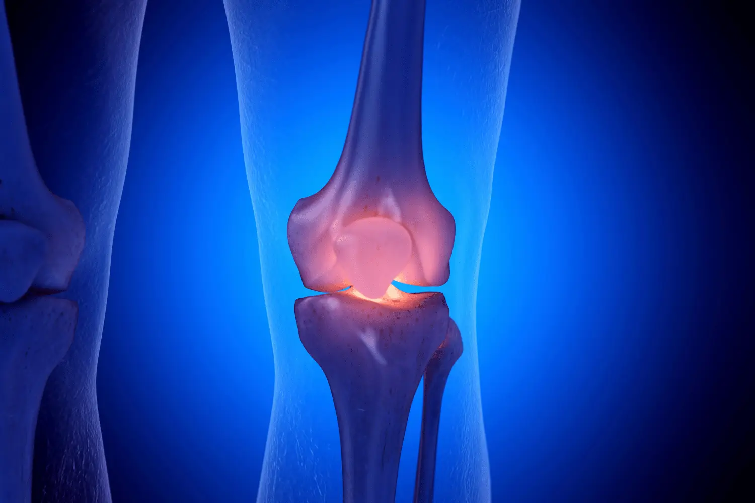 Knee Replacement Surgery in Coimbatore – Advanced Joint Care