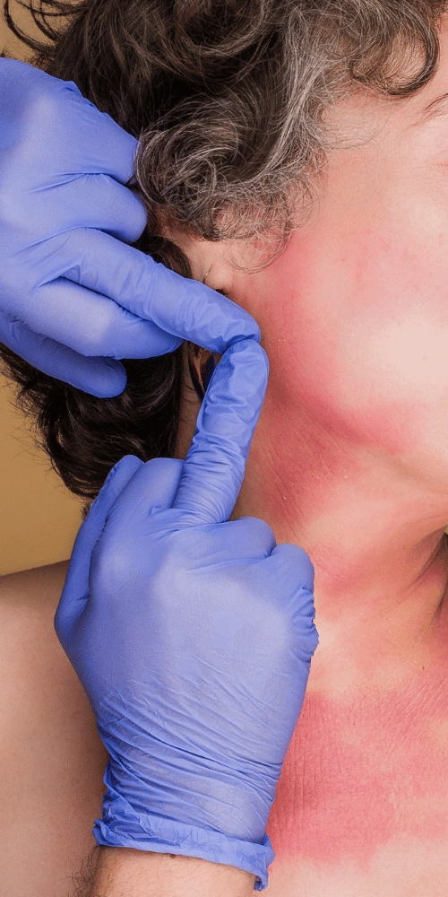 Experience fast, gentle skincare solutions with the best eczema treatment in Coimbatore for lasting relief.